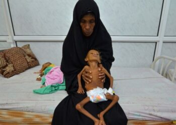 La guerra de agresión de la OTAN árabe y el hambre matan en Yemen un niño o niña cada diez minutos