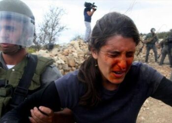 Mujer palestina queda ciega por impacto de bala israelí