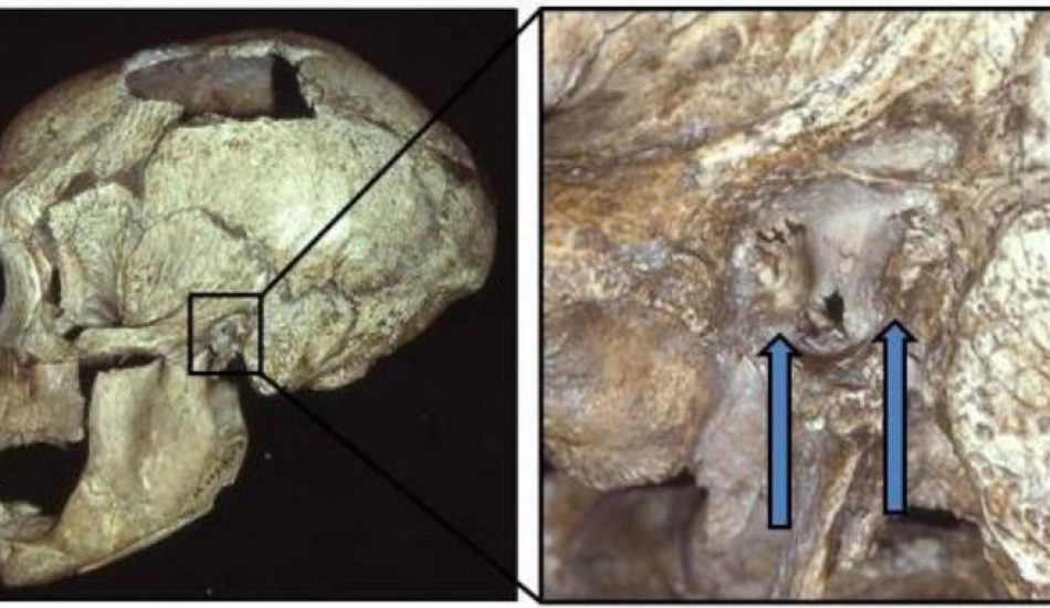El oído de surfista era común entre los neandertales