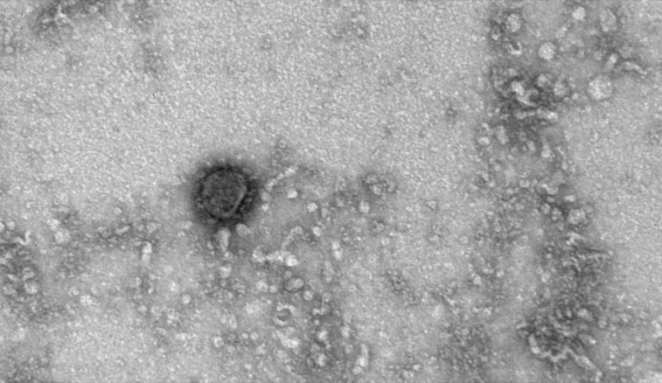 Nuevo avance: Expertos rusos descifran el genoma del coronavirus