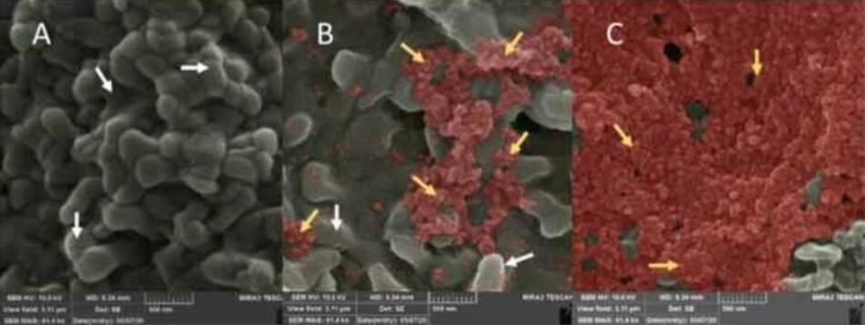 Científicos cubanos captan primeras imágenes del virus SARS-CoV-2