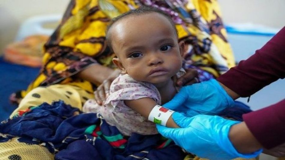 Más de 350.000 niños en Somalia podrían morir por desnutrición