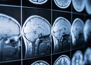 El cerebro humano sigue su construcción después de nacer