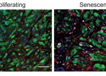 La senescencia abre una nueva diana terapéutica contra los tumores