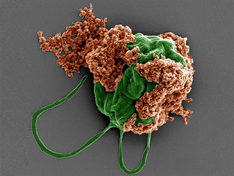 Microrobots nadadores llevan fármacos contra tumores metastásicos a los pulmones