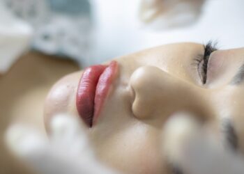 Efectos de Restylane: Lo Que Necesitas Saber Antes de Tu Tratamiento