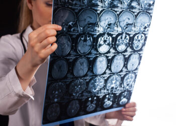 Bridging Medicine and Law in Brain Injury Cases