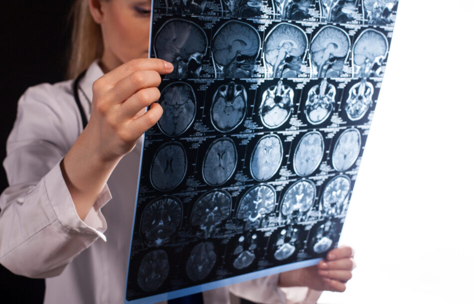 Bridging Medicine and Law in Brain Injury Cases