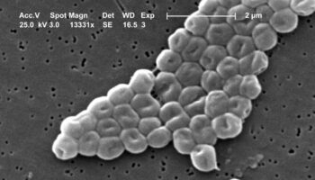 La batalla entre dos virus en una bacteria abre nuevas vías contra la resistencia a antibióticos