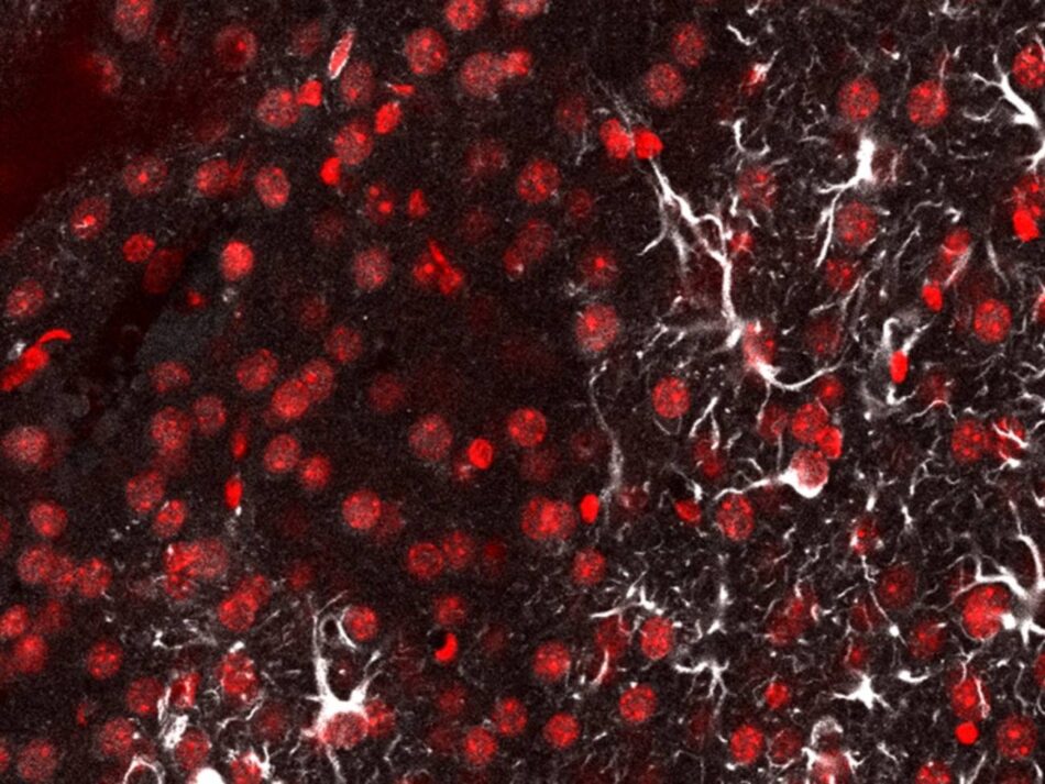 Una ‘linterna molecular’ detecta metástasis cerebral en ratones con una sonda de luz ultrafina